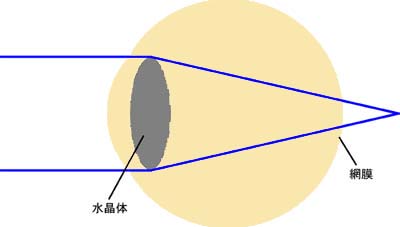 eye2.jpg